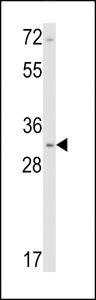 CNN1 / Calponin Antibody - Western blot of Calponin-1 Antibody in NCI-H460 cell line lysates (35 ug/lane). CNN1 (arrow) was detected using the purified antibody.