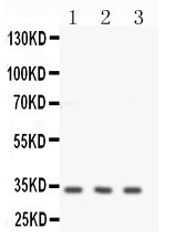 CNN1 / Calponin Antibody - Anti-Calponin antibody,Western blotting All lanes: Anti -Calponin at 0.5ug/ml Lane 1: HELA Whole Cell Lysate at 40ugLane 2: JURKAT Whole Cell Lysate at 40ugLane 3: MCF-7 Whole Cell Lysate at 40ugPredicted bind size: 33KD Observed bind size: 33KD