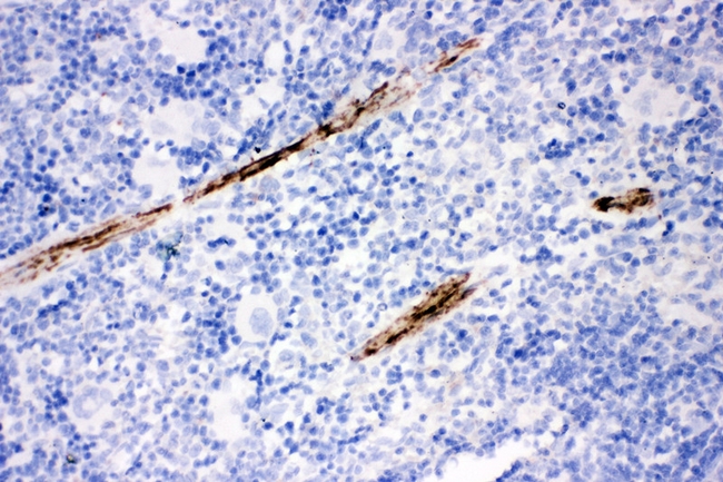CNN1 / Calponin Antibody - IHC analysis of Calponin using anti-Calponin antibody. Calponin was detected in paraffin-embedded section of mouse spleen tissue. Heat mediated antigen retrieval was performed in citrate buffer (pH6, epitope retrieval solution) for 20 mins. The tissue section was blocked with 10% goat serum. The tissue section was then incubated with 1µg/ml rabbit anti-Calponin Antibody overnight at 4°C. Biotinylated goat anti-rabbit IgG was used as secondary antibody and incubated for 30 minutes at 37°C. The tissue section was developed using Strepavidin-Biotin-Complex (SABC) with DAB as the chromogen.