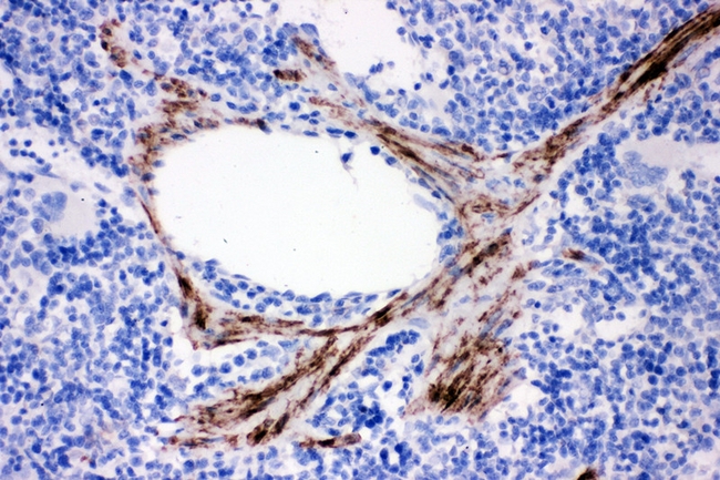 CNN1 / Calponin Antibody - IHC analysis of Calponin using anti-Calponin antibody. Calponin was detected in paraffin-embedded section of rat spleen tissue. Heat mediated antigen retrieval was performed in citrate buffer (pH6, epitope retrieval solution) for 20 mins. The tissue section was blocked with 10% goat serum. The tissue section was then incubated with 1µg/ml rabbit anti-Calponin Antibody overnight at 4°C. Biotinylated goat anti-rabbit IgG was used as secondary antibody and incubated for 30 minutes at 37°C. The tissue section was developed using Strepavidin-Biotin-Complex (SABC) with DAB as the chromogen.