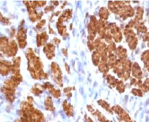 CNN1 / Calponin Antibody - IHC testing of FFPE rat uterus and Calponin antibody (clone CLPN5-1).  This image was taken for the unmodified form of this product. Other forms have not been tested.
