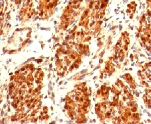 CNN1 / Calponin Antibody - IHC testing of FFPE human uterus and Calponin antibody (clone CLPN5-1).  This image was taken for the unmodified form of this product. Other forms have not been tested.