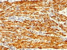 CNN1 / Calponin Antibody - Formalin-fixed, paraffin-embedded Human Uterus stained with Calponin Rabbit Recombinant Monoclonal Antibody (CNN1/1408R).