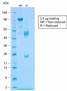 CNN1 / Calponin Antibody - SDS-PAGE Analysis of Purified Calponin Rabbit Recombinant Monoclonal Antibody (CNN1/1408R). Confirmation of Purity and Integrity of Antibody.