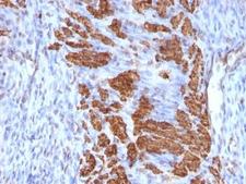 CNN1 / Calponin Antibody - Formalin-fixed, paraffin-embedded rat uterus stained with Calponin antibody (CNN1/832 + CALP).  This image was taken for the unmodified form of this product. Other forms have not been tested.