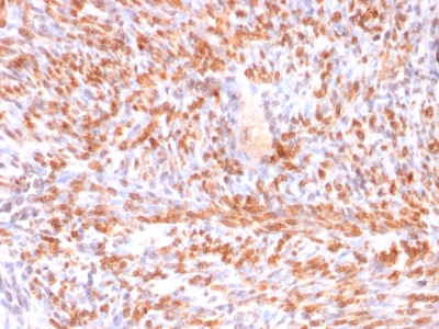 CNN1 / Calponin Antibody - Formalin-fixed, paraffin-embedded human Uterus stained with Calponin-1 Recombinant Mouse Monoclonal Antibody (rCNN1/832).