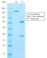 CNN1 / Calponin Antibody - SDS-PAGE Analysis Purified Calponin-1 Recombinant Mouse Monoclonal Antibody (rCNN1/832). Confirmation of Purity and Integrity of Antibody.