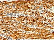 CNN1 / Calponin Antibody - Formalin-fixed, paraffin-embedded human uterus stained with Calponin antibody (SPM169).  This image was taken for the unmodified form of this product. Other forms have not been tested.