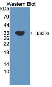 CNN2 Antibody - Western blot of CNN2 antibody.