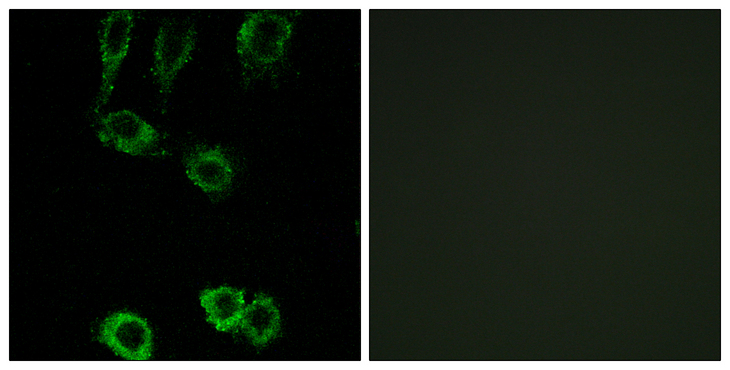 CNN2 Antibody - Immunofluorescence analysis of A549 cells, using CNN2 Antibody. The picture on the right is blocked with the synthesized peptide.