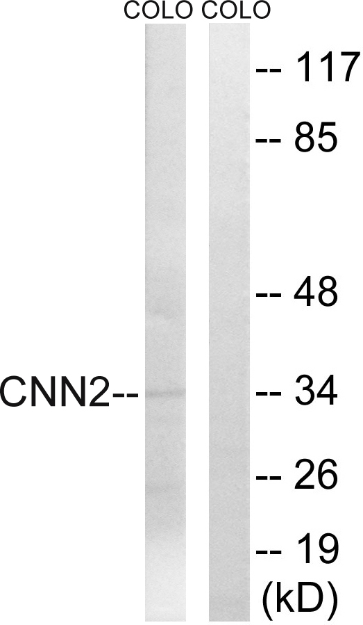 CNN2 Antibody - Western blot analysis of lysates from COLO cells, using CNN2 Antibody. The lane on the right is blocked with the synthesized peptide.