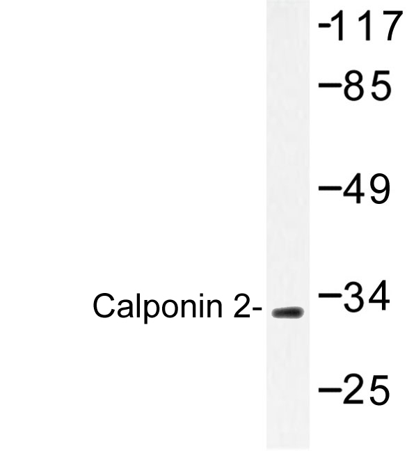 CNN2 Antibody - Western blot of Calponin 2 (D156) pAb in extracts from HUVEC cells.