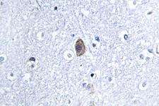 CNN2 Antibody - IHC of Calponin 2 (D156) pAb in paraffin-embedded human brain tissue.