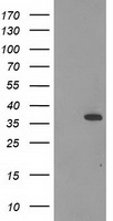 CNN2 Antibody - HEK293T cells were transfected with the pCMV6-ENTRY control (Left lane) or pCMV6-ENTRY CNN2 (Right lane) cDNA for 48 hrs and lysed. Equivalent amounts of cell lysates (5 ug per lane) were separated by SDS-PAGE and immunoblotted with anti-CNN2.