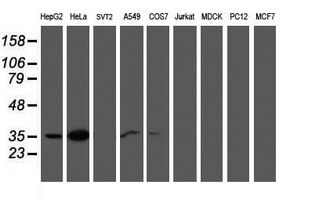 CNN2 Antibody - Western blot of extracts (35ug) from 9 different cell lines by using anti-CNN2 monoclonal antibody.