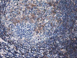 CNN2 Antibody - IHC of paraffin-embedded Human tonsil using anti-CNN2 mouse monoclonal antibody. (Heat-induced epitope retrieval by 10mM citric buffer, pH6.0, 100C for 10min).