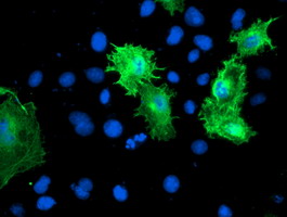 CNN2 Antibody - Anti-CNN2 mouse monoclonal antibody immunofluorescent staining of COS7 cells transiently transfected by pCMV6-ENTRY CNN2.