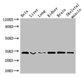 CNN2 Antibody - Positive WB detected in:Hela whole cell lysate,Mouse liver tissue,Mouse lung tissue,Mouse kidney tissue,Mouse brain tissue,Mouse skeletal muscle tissue;All lanes: CNN2 antibody at 2.5ug/ml;Secondary;Goat polyclonal to rabbit IgG at 1/50000 dilution;Predicted band size: 34,30 kDa;Observed band size: 34 kDa;