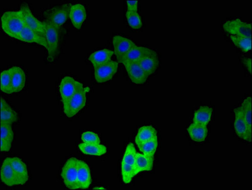 CNN2 Antibody - Immunofluorescent analysis of HepG2 cells using CNN2 Antibody at a dilution of 1:100 and Alexa Fluor 488-congugated AffiniPure Goat Anti-Rabbit IgG(H+L)
