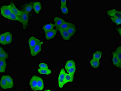 CNN2 Antibody - Immunofluorescent analysis of HepG2 cells using CNN2 Antibody at dilution of 1:100 and Alexa Fluor 488-congugated AffiniPure Goat Anti-Rabbit IgG(H+L)