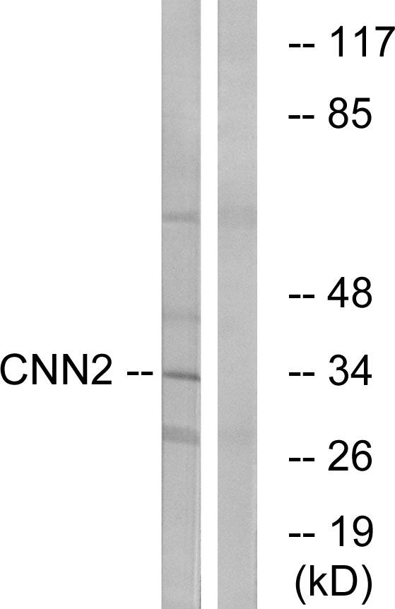 CNN2 Antibody - Western blot analysis of extracts from HUVEC cells, using CNN2 antibody.