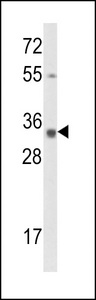 CNN3 Antibody - Western blot of Calponin-3 Antibody in A2058 cell line lysates (35 ug/lane). Calponin-3 (arrow) was detected using the purified antibody.