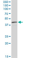 CNN3 Antibody - CNN3 monoclonal antibody (M01), clone 4C4. Western blot of CNN3 expression in HepG2.