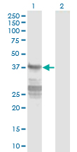 CNN3 Antibody - Western blot of CNN3 expression in transfected 293T cell line by CNN3 monoclonal antibody (M01), clone 4C4.