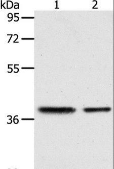 CNN3 Antibody - Western blot analysis of Human fetal kidney and fetal muscle tissue, using CNN3 Polyclonal Antibody at dilution of 1:400.