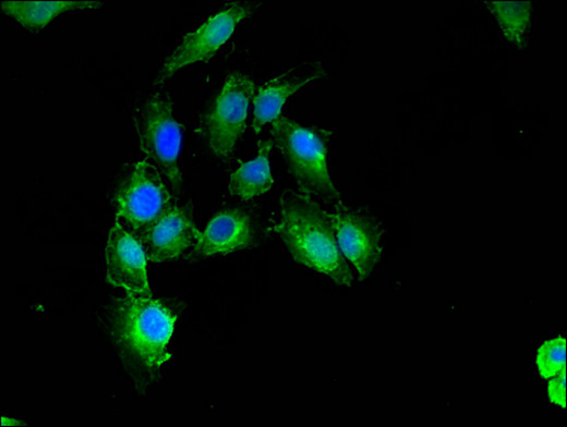 CNN3 Antibody - Immunofluorescent analysis of Hela cells using CNN3 Antibody at a dilution of 1:100 and Alexa Fluor 488-congugated AffiniPure Goat Anti-Rabbit IgG(H+L)
