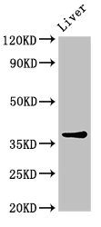 CNN3 Antibody - Western Blot Positive WB detected in: Mouse liver tissue All lanes: CNN3 antibody at 3.4µg/ml Secondary Goat polyclonal to rabbit IgG at 1/50000 dilution Predicted band size: 37, 32 kDa Observed band size: 37 kDa