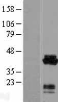 CNN3 Protein - Western validation with an anti-DDK antibody * L: Control HEK293 lysate R: Over-expression lysate