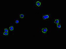 CNNM1 Antibody - Immunofluorescent analysis of HepG2 cells using CNNM1 Antibody at dilution of 1:100 and Alexa Fluor 488-congugated AffiniPure Goat Anti-Rabbit IgG(H+L)