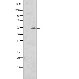 CNNM1 Antibody - Western blot analysis of CNNM1 expression in human tonsil tissue lysate. The lane on the left is treated with the antigen-specific peptide.