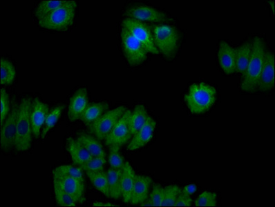 CNNM2 Antibody - Immunofluorescence staining of HepG2 cells diluted at 1:100, counter-stained with DAPI. The cells were fixed in 4% formaldehyde, permeabilized using 0.2% Triton X-100 and blocked in 10% normal Goat Serum. The cells were then incubated with the antibody overnight at 4°C.The Secondary antibody was Alexa Fluor 488-congugated AffiniPure Goat Anti-Rabbit IgG (H+L).