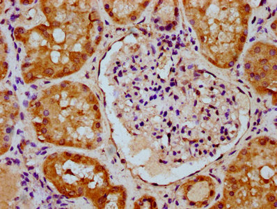 CNNM2 Antibody - Immunohistochemistry Dilution at 1:300 and staining in paraffin-embedded human kidney tissue performed on a Leica BondTM system. After dewaxing and hydration, antigen retrieval was mediated by high pressure in a citrate buffer (pH 6.0). Section was blocked with 10% normal Goat serum 30min at RT. Then primary antibody (1% BSA) was incubated at 4°C overnight. The primary is detected by a biotinylated Secondary antibody and visualized using an HRP conjugated SP system.