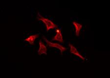 CNNM2 Antibody - Staining HeLa cells by IF/ICC. The samples were fixed with PFA and permeabilized in 0.1% Triton X-100, then blocked in 10% serum for 45 min at 25°C. The primary antibody was diluted at 1:200 and incubated with the sample for 1 hour at 37°C. An Alexa Fluor 594 conjugated goat anti-rabbit IgG (H+L) Ab, diluted at 1/600, was used as the secondary antibody.