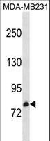 CNNM3 Antibody - CNNM3 Antibody western blot of MDA-MB231 cell line lysates (35 ug/lane). The CNNM3 antibody detected the CNNM3 protein (arrow).