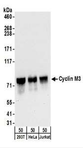 CNNM3 Antibody - Detection of Human Cyclin M3 by Western Blot. Samples: Whole cell lysate from 293T, HeLa, and Jurkat cells. Antibodies: Affinity purified rabbit anti-Cyclin M3 antibody used for WB at 0.1 ug/ml. Detection: Chemiluminescence with an exposure time of 30 seconds.