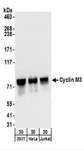 CNNM3 Antibody - Detection of Human Cyclin M3 by Western Blot. Samples: Whole cell lysate from 293T, HeLa, and Jurkat cells. Antibodies: Affinity purified rabbit anti-Cyclin M3 antibody used for WB at 0.1 ug/ml. Detection: Chemiluminescence with an exposure time of 30 seconds.