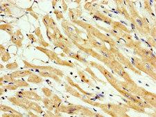 CNNM3 Antibody - Immunohistochemistry image at a dilution of 1:200 and staining in paraffin-embedded human heart tissue performed on a Leica BondTM system. After dewaxing and hydration, antigen retrieval was mediated by high pressure in a citrate buffer (pH 6.0) . Section was blocked with 10% normal goat serum 30min at RT. Then primary antibody (1% BSA) was incubated at 4 °C overnight. The primary is detected by a biotinylated secondary antibody and visualized using an HRP conjugated SP system.