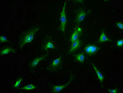 CNNM3 Antibody - Immunofluorescence staining of U251 cells with CNNM3 Antibody at 1:66, counter-stained with DAPI. The cells were fixed in 4% formaldehyde, permeabilized using 0.2% Triton X-100 and blocked in 10% normal Goat Serum. The cells were then incubated with the antibody overnight at 4°C. The secondary antibody was Alexa Fluor 488-congugated AffiniPure Goat Anti-Rabbit IgG(H+L).