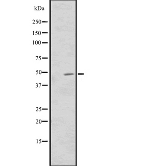 CNNM3 Antibody - Western blot analysis of CNNM3 expression in Transfected 293T cells lysate. The lane on the left is treated with the antigen-specific peptide.