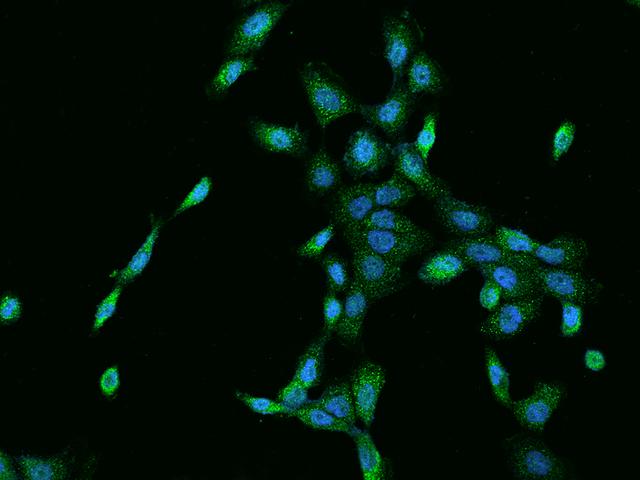 CNNM3 Antibody - Immunofluorescence staining of CNNM3 in A431 cells. Cells were fixed with 4% PFA, permeabilzed with 0.1% Triton X-100 in PBS, blocked with 10% serum, and incubated with rabbit anti-Human CNNM3 polyclonal antibody (dilution ratio 1:200) at 4°C overnight. Then cells were stained with the Alexa Fluor 488-conjugated Goat Anti-rabbit IgG secondary antibody (green) and counterstained with DAPI (blue). Positive staining was localized to Cytoplasm.