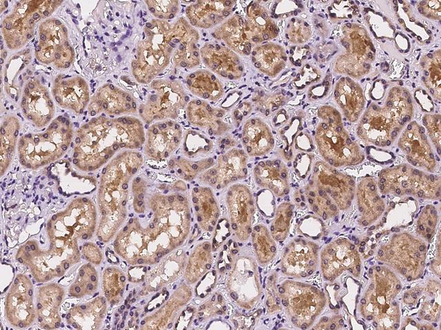 CNNM3 Antibody - Immunochemical staining of human CNNM3 in human kidney with rabbit polyclonal antibody at 1:100 dilution, formalin-fixed paraffin embedded sections.