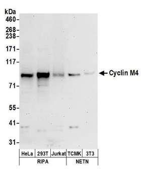 CNNM4 Antibody - Detection of human and mouse Cyclin M4 by western blot. Samples: Whole cell lysate (50 µg) from HeLa, HEK293T, Jurkat, mouse TCMK-1, and mouse NIH 3T3 cells prepared using NETN and RIPA lysis buffer. Antibodies: Affinity purified rabbit anti-Cyclin M4 antibody used for WB at 0.4 µg/ml. Detection: Chemiluminescence with an exposure time of 30 seconds.