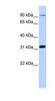CNNM4 Antibody - CNNM4 antibody Western blot of 721_B cell lysate. This image was taken for the unconjugated form of this product. Other forms have not been tested.