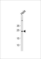 CNO Antibody - CNO Antibody western blot of HeLa cell line lysates (35 ug/lane). The CNO antibody detected the CNO protein (arrow).