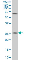 CNO Antibody - CNO monoclonal antibody (M02), clone 6C3 Western blot of CNO expression in HeLa.