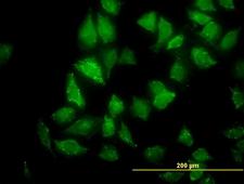 CNO Antibody - Immunofluorescence of monoclonal antibody to CNO on HeLa cell (antibody concentration 10 ug/ml).